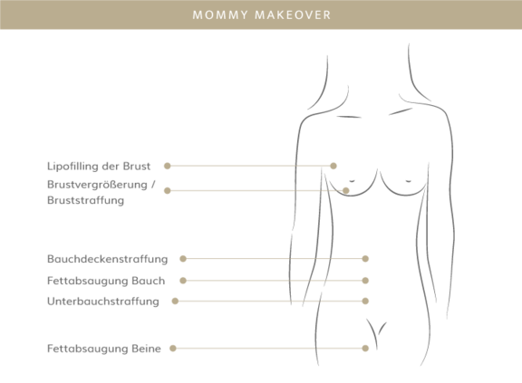 Mommy Makeover, Plastische & Ästhetische Chirurgie in Stuttgart, Dr. Schumacher