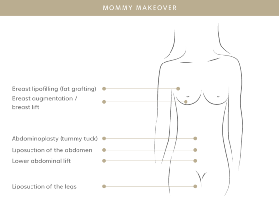 Mommy Makeover, Plastische & Ästhetische Chirurgie in Stuttgart, Dr. Schumacher