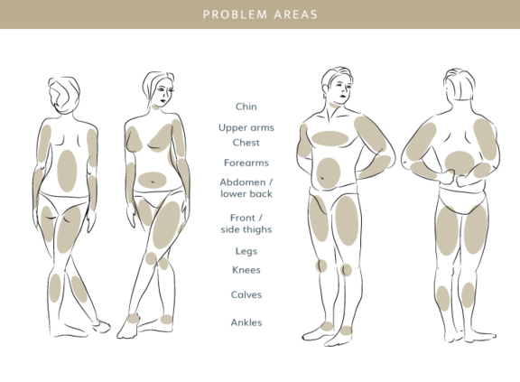 Fettabsaugung, Plastische & Ästhetische Chirurgie in Stuttgart, Dr. Schumacher