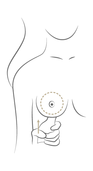 Brustvergrößerung Motiva Preservé™, Plastische & Ästhetische Chirurgie in Stuttgart, Dr. Schumacher